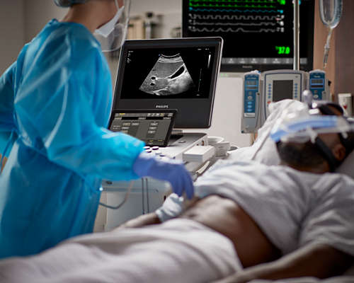 Compact Ultrasound 5300 series