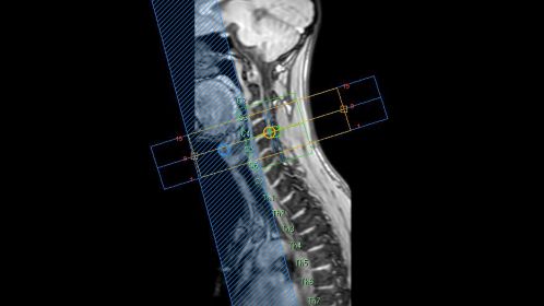SmartExam Spine