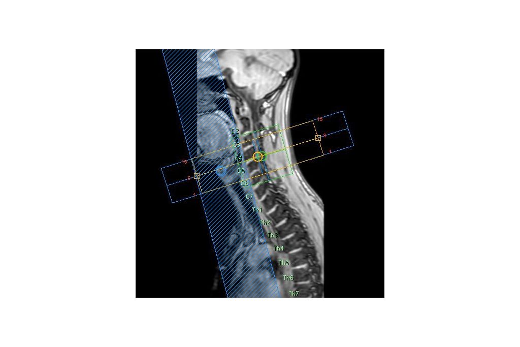 SmartExam Spine