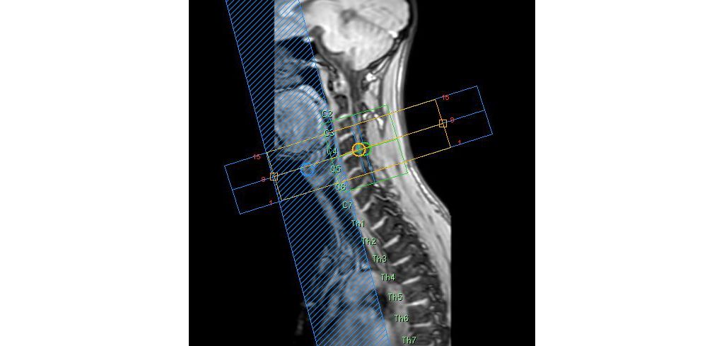 SmartExam Spine