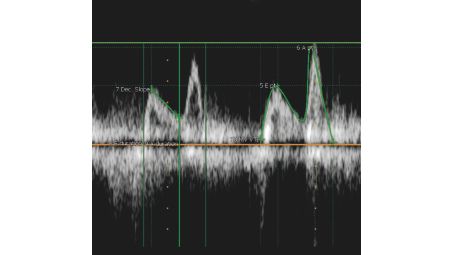 Kardiologische Messungen