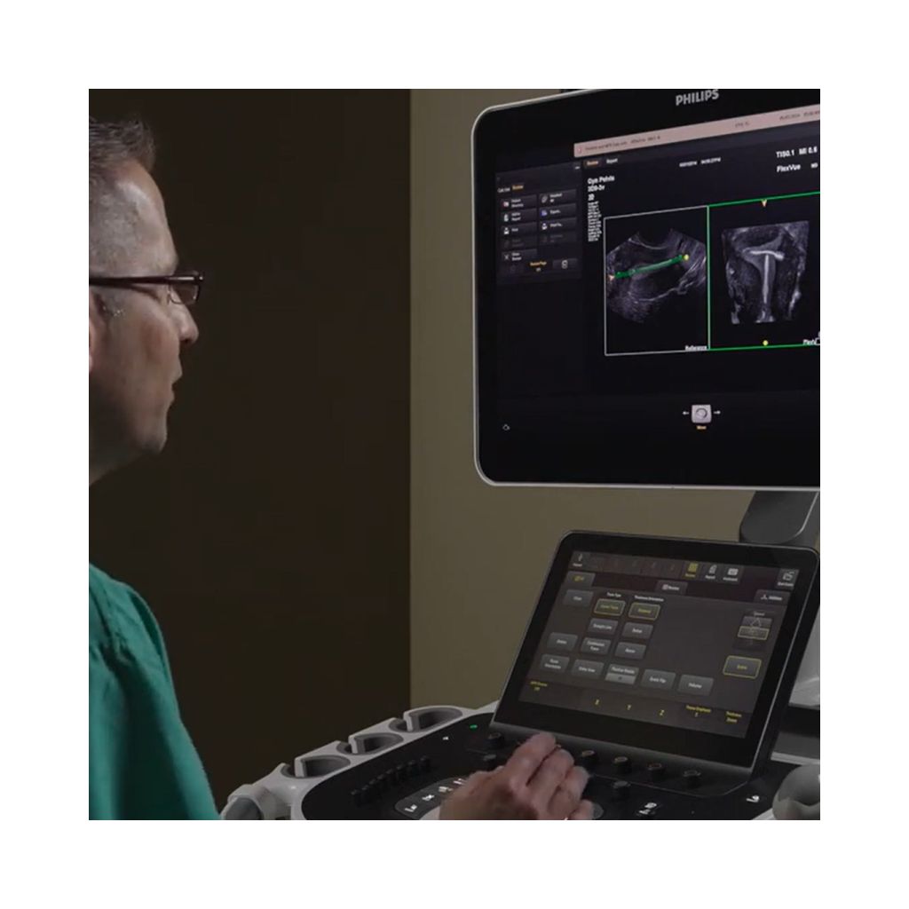  Video of Dr. Michael Ruma discussing FlexVue and FlexVue Volume advanced 3D evaluation tools.