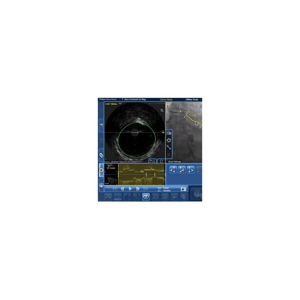 IVUS co-registration