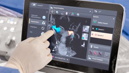 3D imaging at tableside​
