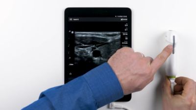 Perform a Lumify Exam
