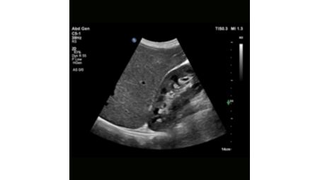 Next Gen Auto Scan
