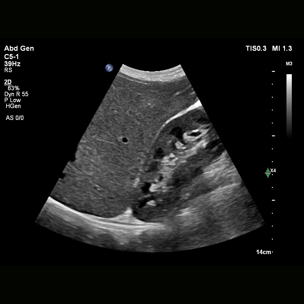 Next Gen Auto Scan