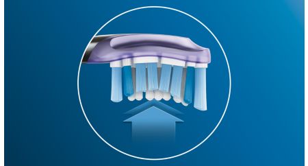 Jusqu’à 100 % d’inflammation gingivale en moins*