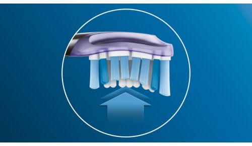 Up to 100% less gingival inflammation*