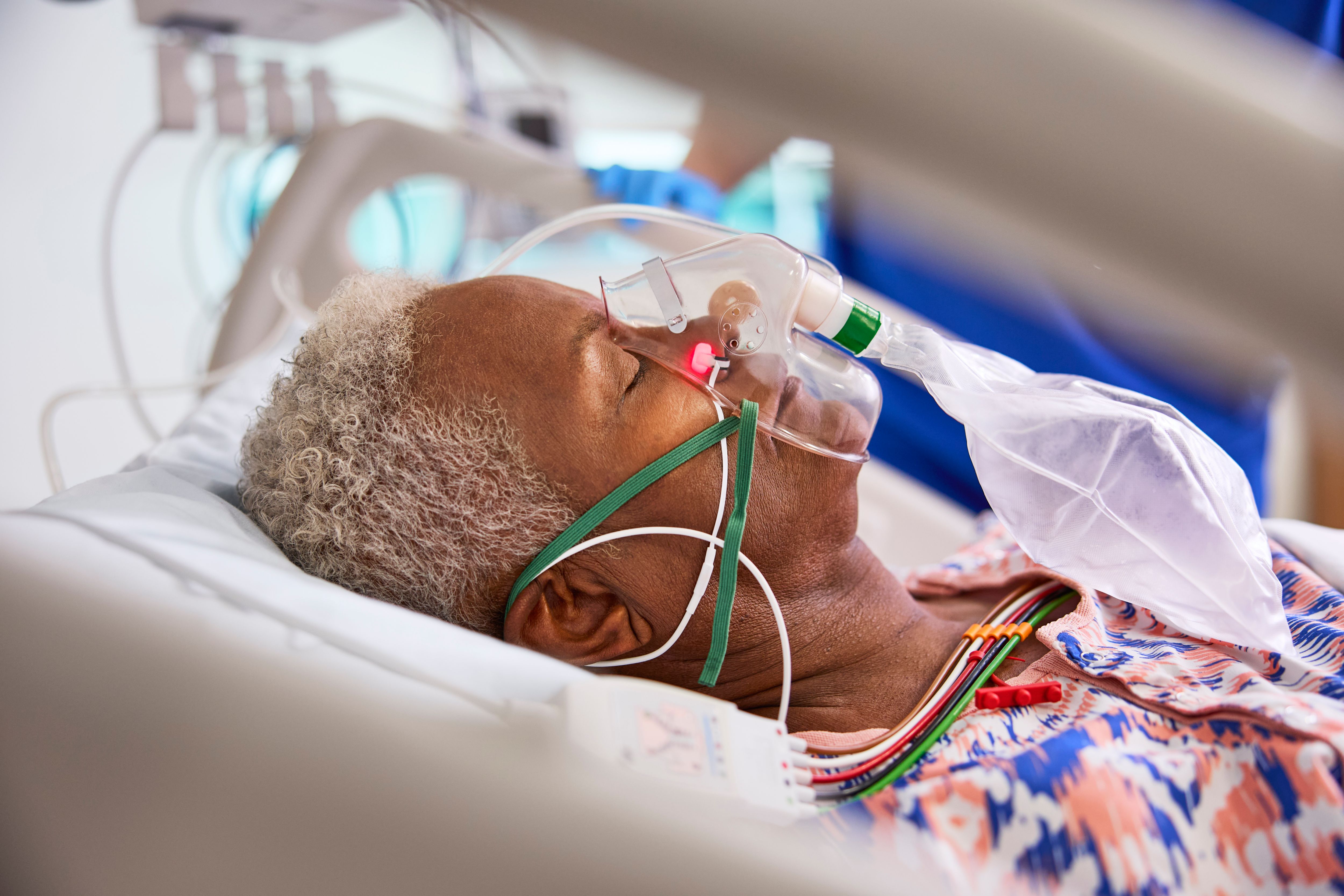 patiënt met ECG-elektroden, een capnografiemasker en een Nasal Alar SpO₂-sensor