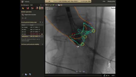 Integrated live image guidance supports precise navigation