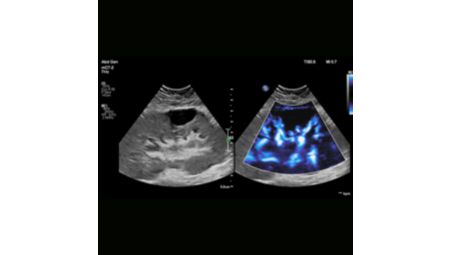 MicroFlow Imaging