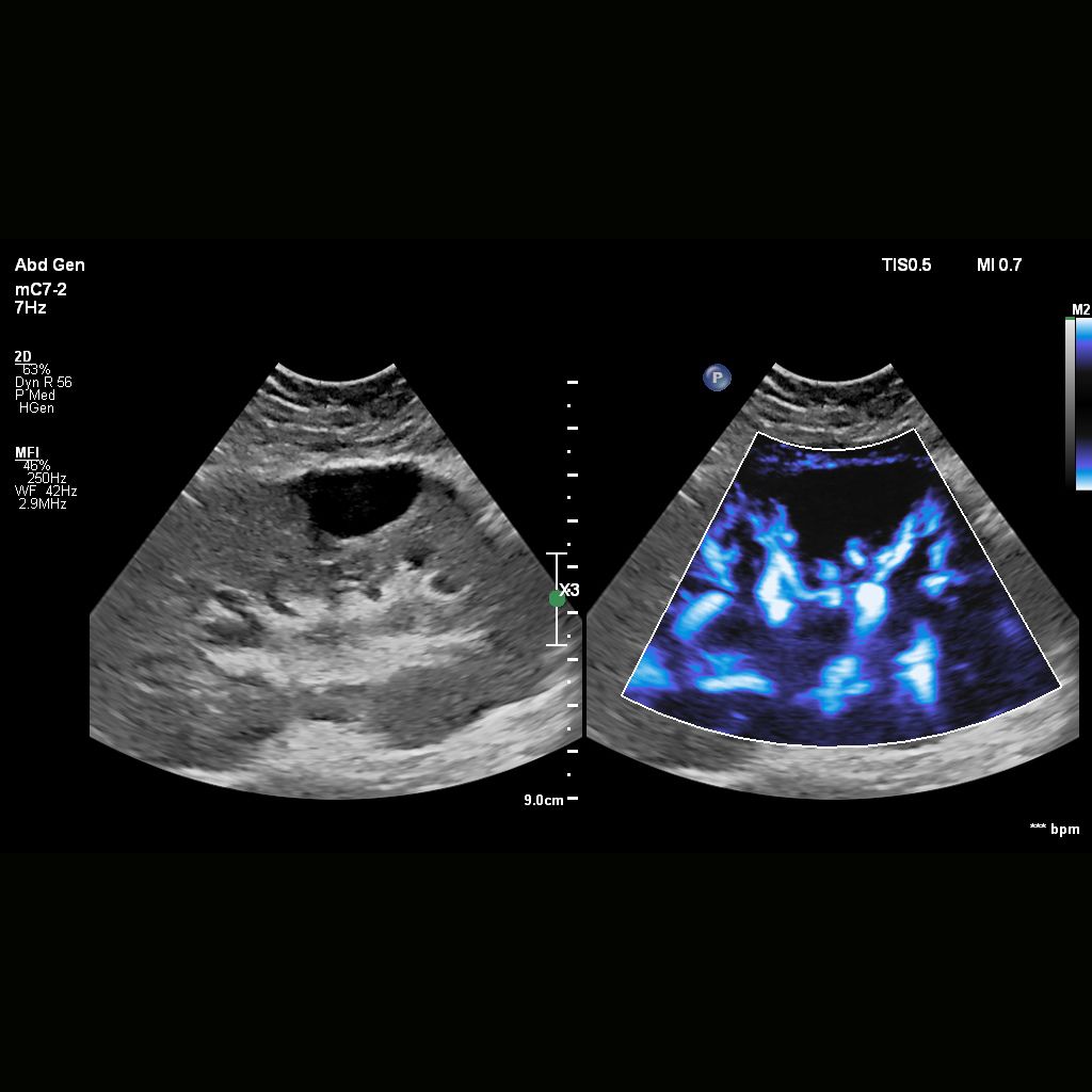MicroFlow Imaging