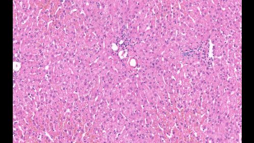 Clinical image digital pathology
