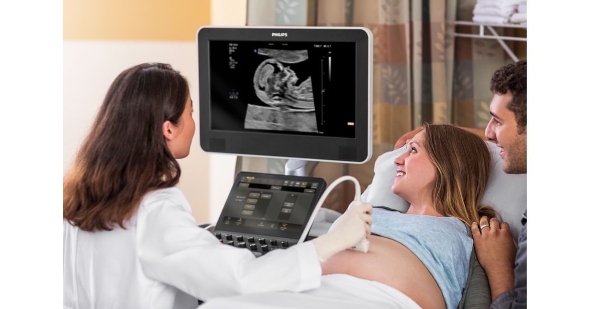 eL18-4 PureWave-transducer - Philips