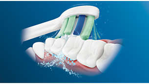 Philips Sonicare -hammasharjan edistynyt Sonic-tekniikka