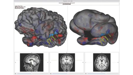 Integrated source imaging