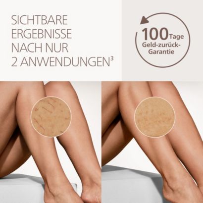 Philips Lumea IPL 8000