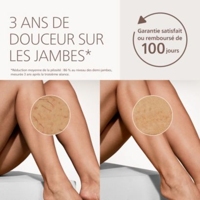 Philips  Lumea IPL 7000 Series