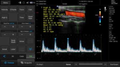 Philips - InnoSight Compact Ultrasound System