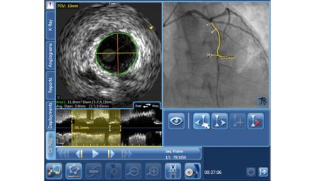 SyncVision compatibility