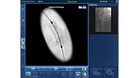 Angio+ device enhancement 