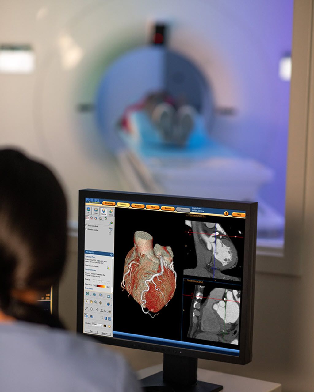Tech looking at cardiac image on screen