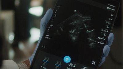 Handheld ultrasound device displaying fetal scan during remote maternal health visit