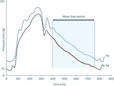 Image showing cardiac cycle
