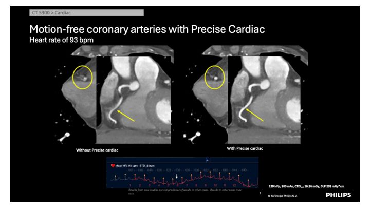 フィリップス製品ユーザーによるセミナー