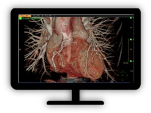 CT Spectral Cardiac Viewer Assists in viewing and evaluating CT images