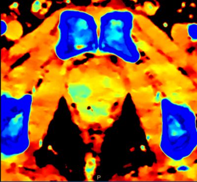 Spectral CT 7500 scanner image