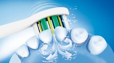 Philips Sonicare's advanced sonic technology