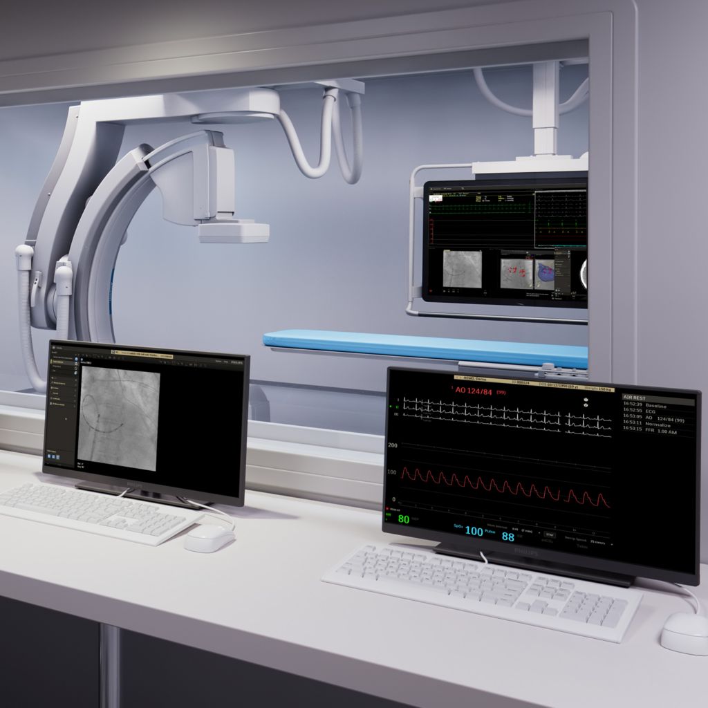 Azurion Control Room workspace