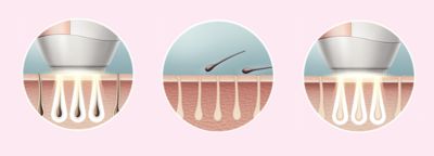 Enjoy smooth skin every day