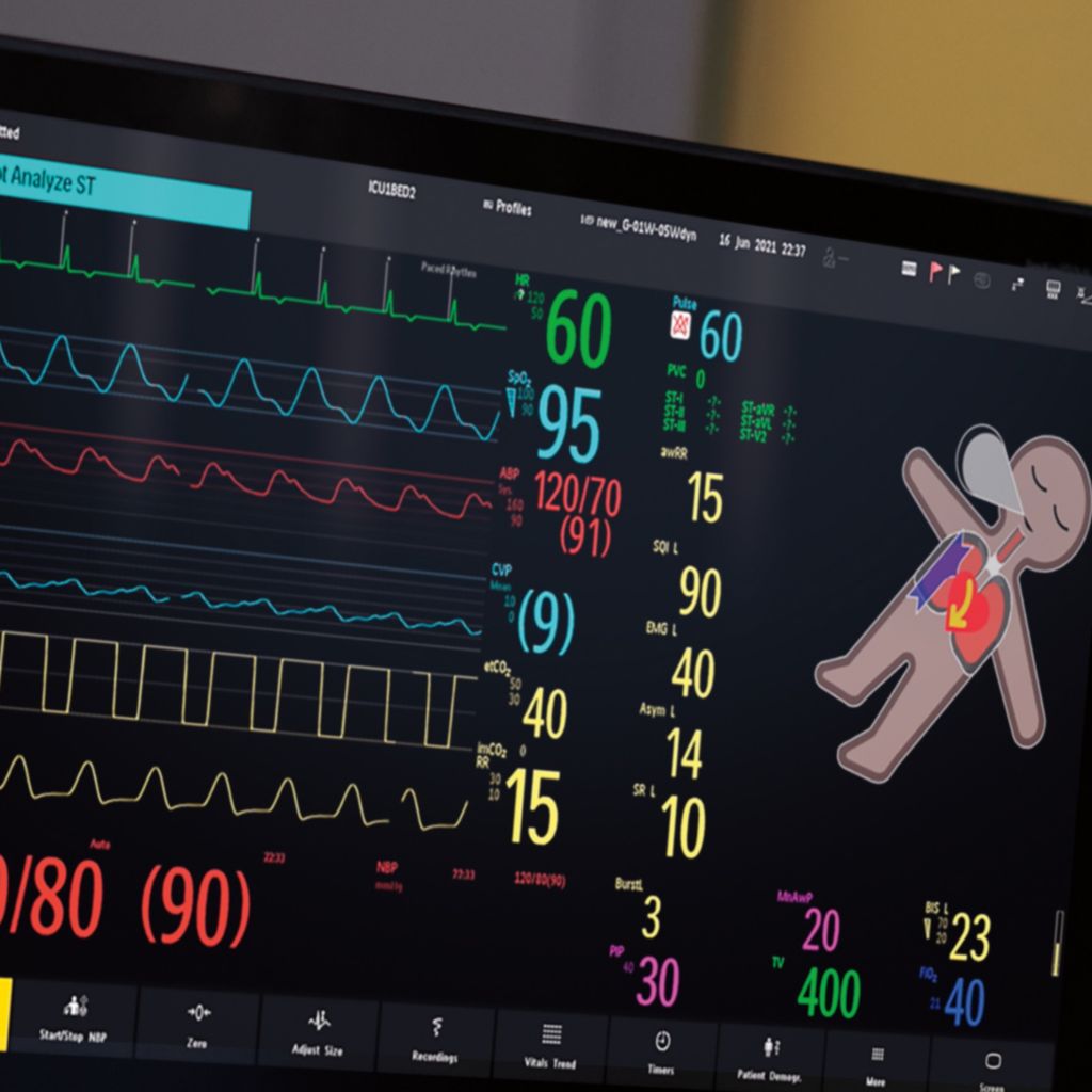  IntelliVue MX 850 patient monitor displaying visual patient avatar