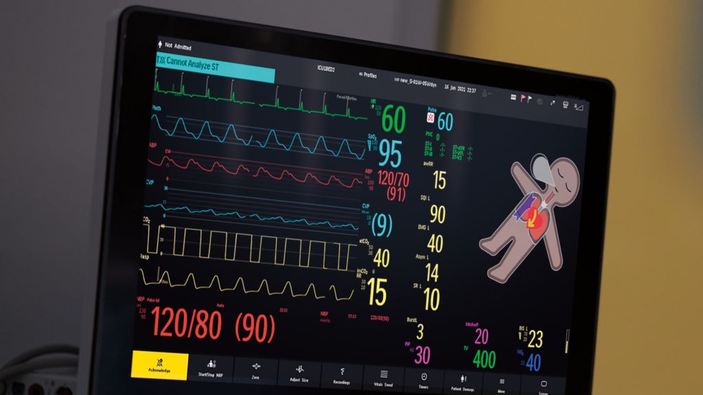 Visual Patient Avatar: A new way to see patients' vitals take shape