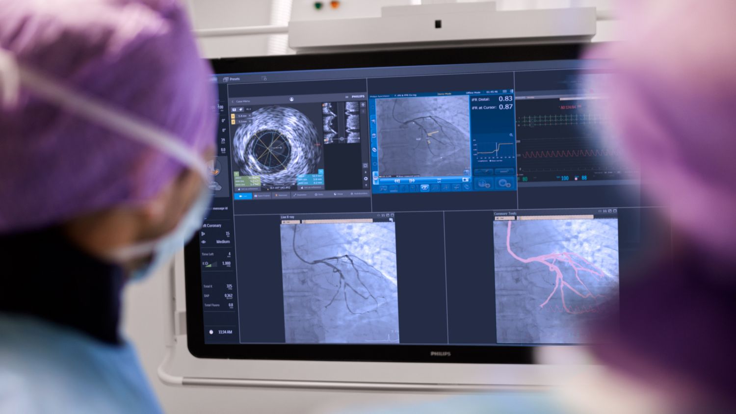 SymphonySuite Cardiovascular ASC and OBL Cath Lab Physicians looking at Monitor for Procedure 