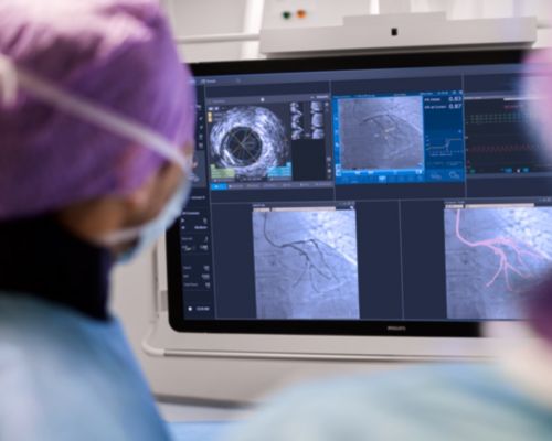 SymphonySuite Cardiovascular ASC and OBL Cath Lab Physicians looking at Monitor for Procedure