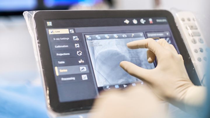 Azurion&nbsp;7シリーズに搭載可能なTouch Screen Module Pro