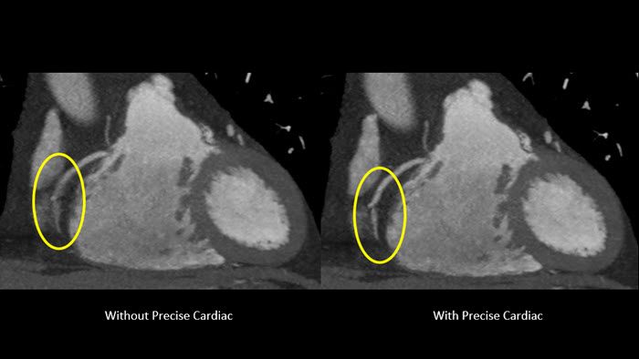 a close-up of a ct scan