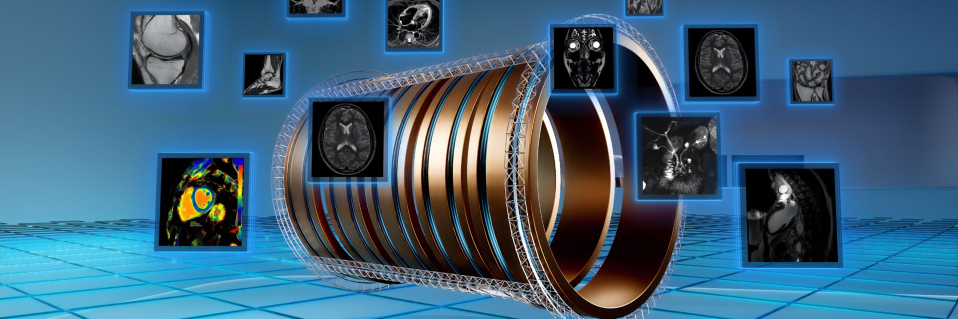 Philips at ISMRM 2026