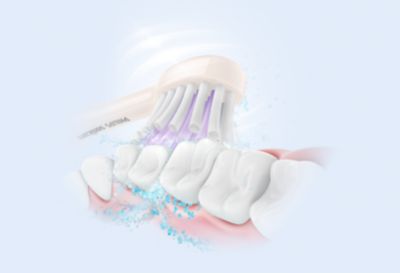 Philips Sonicare 先进的声波技术