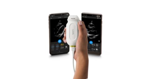 Philips Lumify, il primo ecografo portatile per la diagnosi in tempo reale  degli infortuni