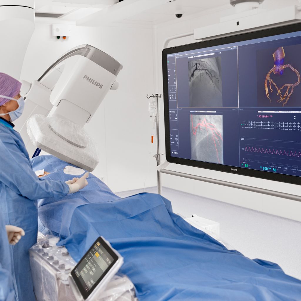 Follow C-arm Azurion cathlab image