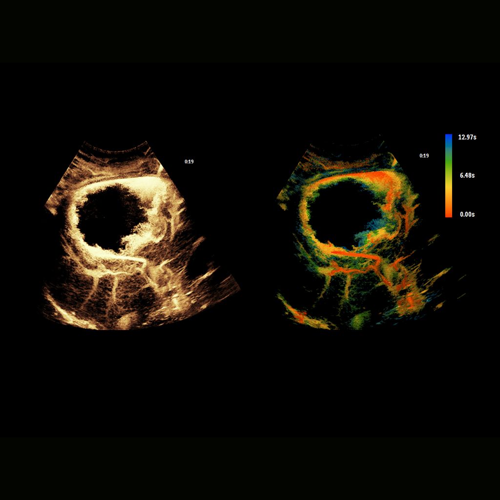 Super Resolution MVI & Time of Arrival