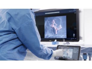 SmartCT Roadmap Live 3D image guidance tool