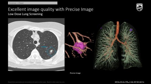 Incisive CT Precise Image