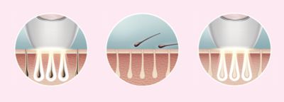 Enjoy smooth skin every day