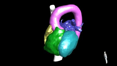 Visualize 3D